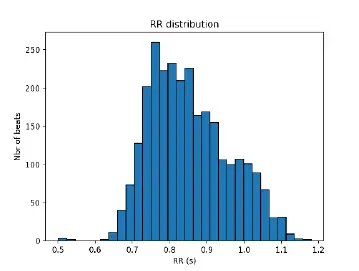Histogram rozkładu odstępów RR