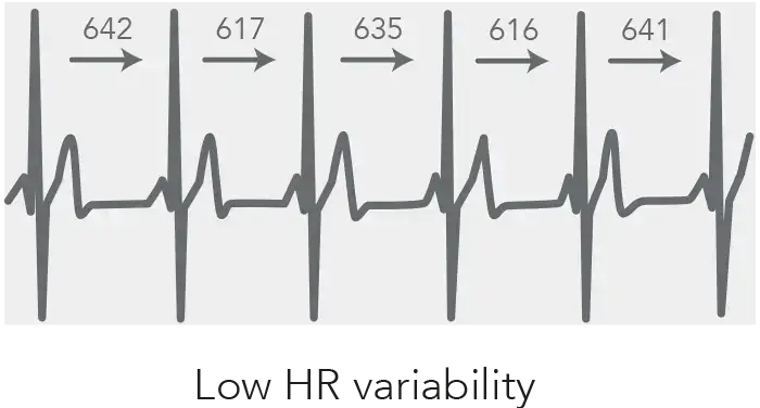Wykres HRV – zdolność regulacyjna ANS